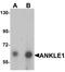 Ankyrin Repeat And LEM Domain Containing 1 antibody, A14094, Boster Biological Technology, Western Blot image 