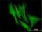 Doublecortin antibody, H00001641-M01, Novus Biologicals, Immunocytochemistry image 