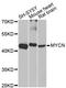 MYCN Proto-Oncogene, BHLH Transcription Factor antibody, A0499, ABclonal Technology, Western Blot image 