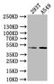 E2F Transcription Factor 2 antibody, CSB-PA623909LA01HU, Cusabio, Western Blot image 