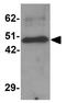 Zinc Finger And BTB Domain Containing 8A antibody, GTX31999, GeneTex, Western Blot image 