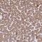 Acyl-CoA Synthetase Medium Chain Family Member 2A antibody, NBP2-46841, Novus Biologicals, Immunohistochemistry paraffin image 