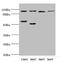 Pitrilysin Metallopeptidase 1 antibody, LS-C676267, Lifespan Biosciences, Western Blot image 