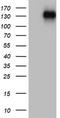 Zinc Finger E-Box Binding Homeobox 1 antibody, LS-C797953, Lifespan Biosciences, Western Blot image 