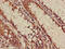 ALOX5 antibody, LS-C375202, Lifespan Biosciences, Immunohistochemistry paraffin image 