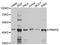 Protein Arginine Methyltransferase 6 antibody, STJ25149, St John
