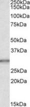 Carbonic Anhydrase 1 antibody, NBP1-36740, Novus Biologicals, Western Blot image 