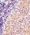 Nuclear Receptor Subfamily 4 Group A Member 2 antibody, M01592, Boster Biological Technology, Immunohistochemistry paraffin image 