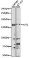 AF4/FMR2 Family Member 1 antibody, 22-565, ProSci, Western Blot image 