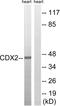 Caudal Type Homeobox 2 antibody, LS-C825549, Lifespan Biosciences, Western Blot image 