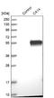 Carbonic Anhydrase 14 antibody, NBP1-87477, Novus Biologicals, Western Blot image 