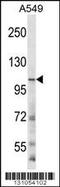 Glutamate Ionotropic Receptor NMDA Type Subunit 3B antibody, 56-326, ProSci, Western Blot image 