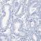 TSPY Like 6 antibody, HPA034700, Atlas Antibodies, Immunohistochemistry paraffin image 