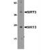 Sirtuin 3 antibody, NBP1-76264, Novus Biologicals, Western Blot image 