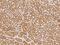 MINDY Lysine 48 Deubiquitinase 4 antibody, 206933-T08, Sino Biological, Immunohistochemistry frozen image 