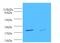 Tryptase Beta 2 (Gene/Pseudogene) antibody, MBS1489920, MyBioSource, Western Blot image 