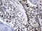 Nibrin antibody, LS-C175574, Lifespan Biosciences, Immunohistochemistry paraffin image 