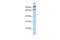 Piezo2 antibody, GTX46024, GeneTex, Western Blot image 