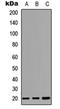 TNF Receptor Superfamily Member 17 antibody, orb234801, Biorbyt, Western Blot image 