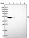 Tyrosine-protein phosphatase non-receptor type 20 antibody, PA5-61707, Invitrogen Antibodies, Western Blot image 