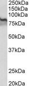 Transglutaminase 2 antibody, LS-C154877, Lifespan Biosciences, Western Blot image 