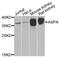 Aspartoacylase antibody, abx005478, Abbexa, Western Blot image 