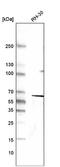 Desmin antibody, NBP2-59056, Novus Biologicals, Western Blot image 