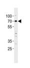 Lysine Acetyltransferase 7 antibody, TA302130, Origene, Western Blot image 