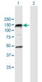 Polyhomeotic Homolog 1 antibody, H00001911-B01P, Novus Biologicals, Western Blot image 