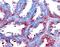 Matrix Metallopeptidase 14 antibody, MAB918, R&D Systems, Immunohistochemistry paraffin image 
