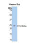 Activin A Receptor Type 1B antibody, LS-C292626, Lifespan Biosciences, Western Blot image 