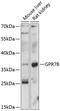 G Protein-Coupled Receptor 78 antibody, 14-379, ProSci, Western Blot image 