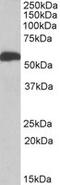 Aldehyde Dehydrogenase 5 Family Member A1 antibody, LS-B11178, Lifespan Biosciences, Western Blot image 