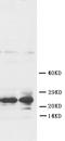 Fibroblast growth factor 8 antibody, PA1216, Boster Biological Technology, Western Blot image 