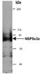 Sperm Antigen With Calponin Homology And Coiled-Coil Domains 1 antibody, NB100-517, Novus Biologicals, Western Blot image 