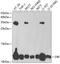 Diazepam Binding Inhibitor, Acyl-CoA Binding Protein antibody, GTX53999, GeneTex, Western Blot image 