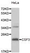 Colony Stimulating Factor 3 antibody, LS-C334541, Lifespan Biosciences, Western Blot image 