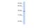 Tetraspanin 10 antibody, A15692, Boster Biological Technology, Western Blot image 