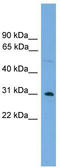 Coiled-Coil Domain Containing 144 Family, N-Terminal Like antibody, TA336187, Origene, Western Blot image 