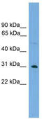 Coiled-Coil Domain Containing 144 Family, N-Terminal Like antibody, TA336187, Origene, Western Blot image 