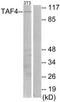 TATA-Box Binding Protein Associated Factor 4 antibody, TA314590, Origene, Western Blot image 