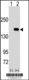 Pumilio RNA Binding Family Member 2 antibody, 62-998, ProSci, Western Blot image 