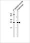 Chymotrypsin Like Elastase 2B antibody, M15911, Boster Biological Technology, Western Blot image 