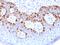 Melan-A antibody, GTX34824, GeneTex, Immunohistochemistry paraffin image 