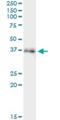 Extended Synaptotagmin 2 antibody, H00057488-M02, Novus Biologicals, Immunoprecipitation image 