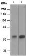 Carbonic Anhydrase 9 antibody, ab108351, Abcam, Western Blot image 