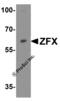 Zinc Finger Protein X-Linked antibody, 6811, ProSci, Western Blot image 