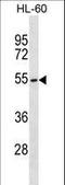 Mannosyl (Beta-1,4-)-Glycoprotein Beta-1,4-N-Acetylglucosaminyltransferase antibody, LS-C164173, Lifespan Biosciences, Western Blot image 