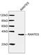 C-C Motif Chemokine Ligand 5 antibody, LS-C203182, Lifespan Biosciences, Western Blot image 