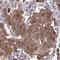 TSN antibody, HPA059561, Atlas Antibodies, Immunohistochemistry paraffin image 